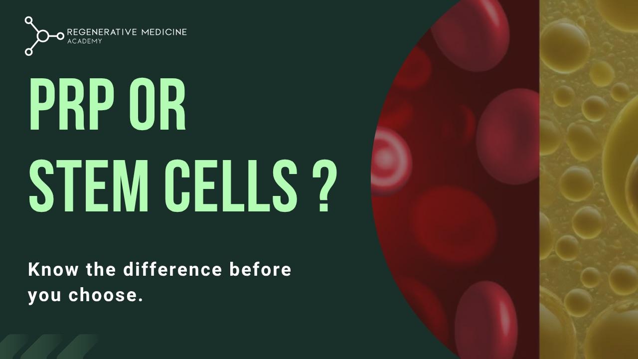 PRP vs stem cell treatment image