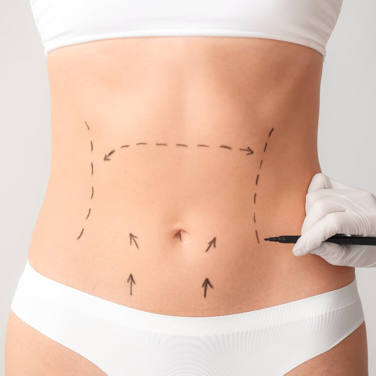 Tao hinh thanh bung 1