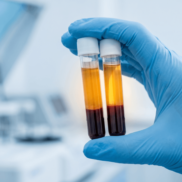 Gloved hand holding two blood tubes used in regenerative medicine, each separated into a golden plasma layer above dark red blood cells