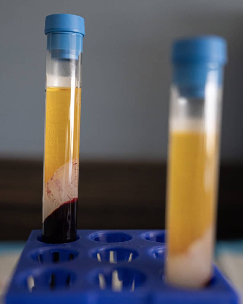 Home 2026 6 Two tubes of spun blood in a rack, the yellow plasma layer above the red cells