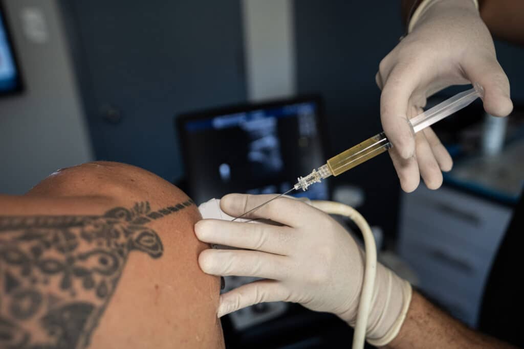 Ultrasound-guided shoulder injection: one gloved hand holds the probe while the other advances the needle