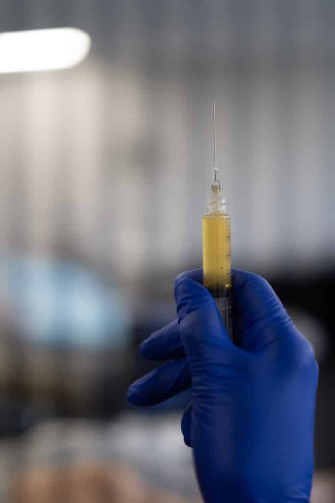 Advanced Prp Msk Course 6 A gloved hand holds up a syringe of prp, needle pointing up