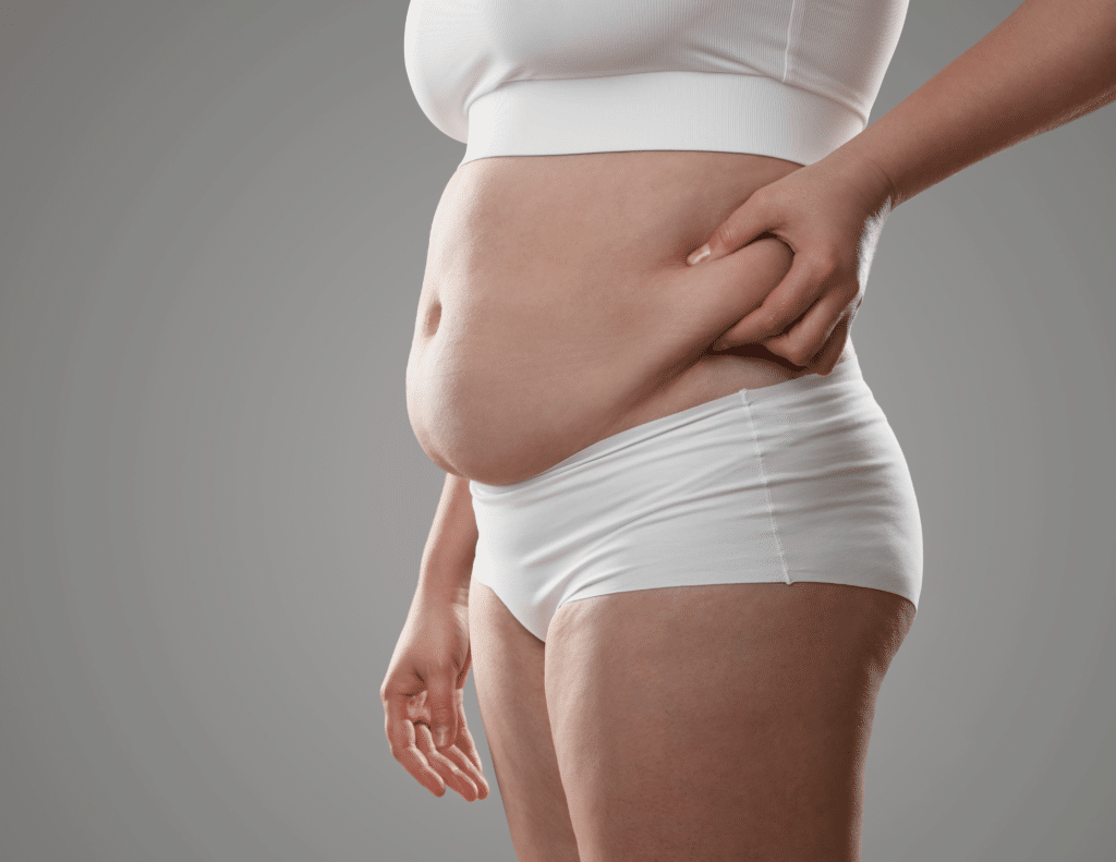 Home 2026 7 A person in white undergarments holds a fold of abdominal fat at the waist