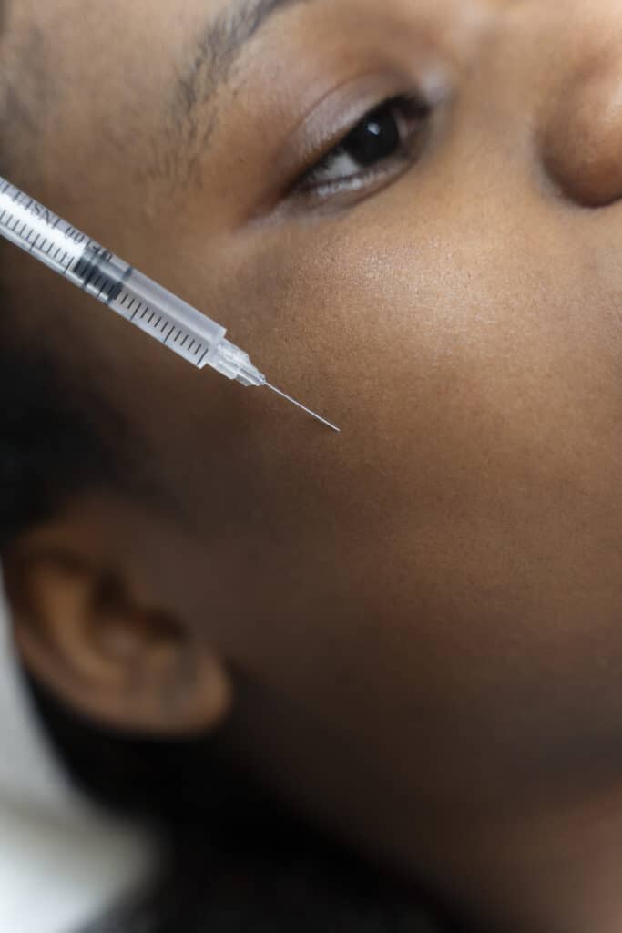 Home 2026 8 A fine needle held close to the cheek of a patient during an aesthetic injection
